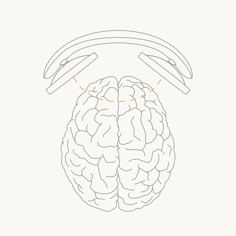 Animation of tDCS stimulating the prefrontal cortex